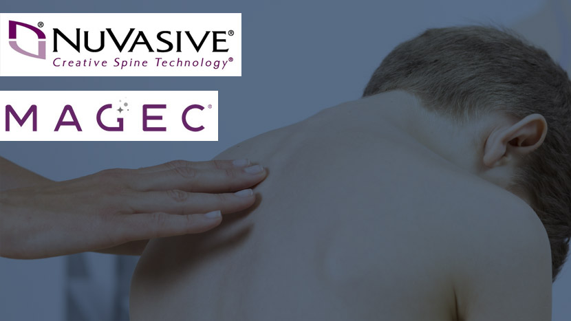 Nuvasive Magec Magnetic Scoliosis Rod System Lawyers Call Us Now