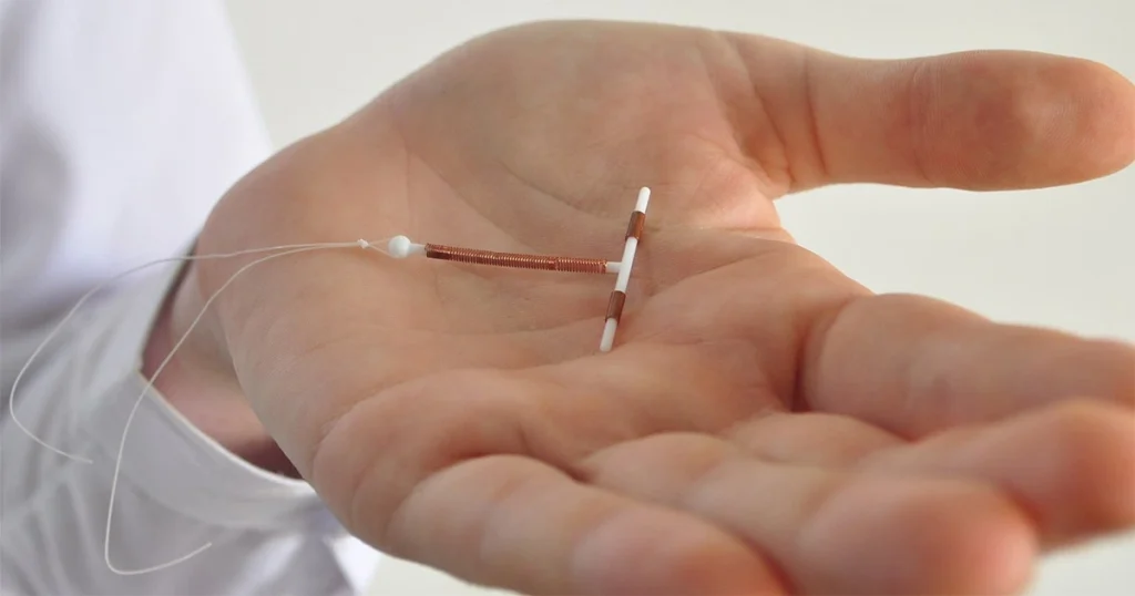 Copper Paragard IUD shown in a person’s hand, illustrating the T-shaped birth control device linked to potential breakage and complications.